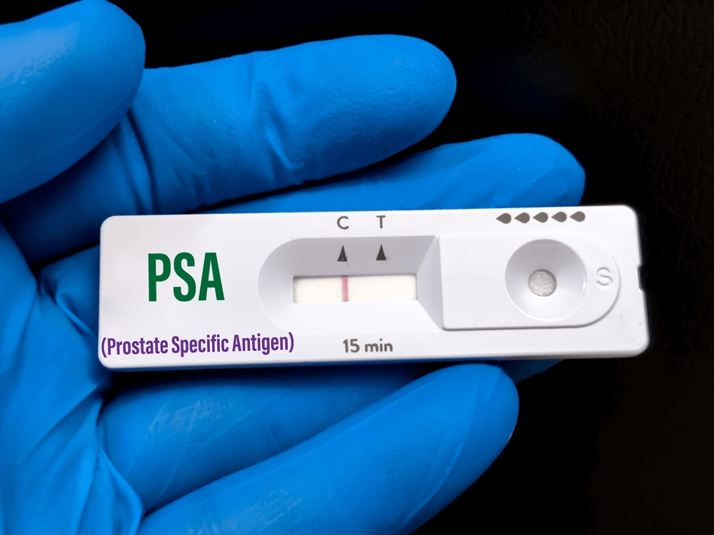 Understanding the Disconnect: Prostatism, Low PSA, and Your Prostate Health