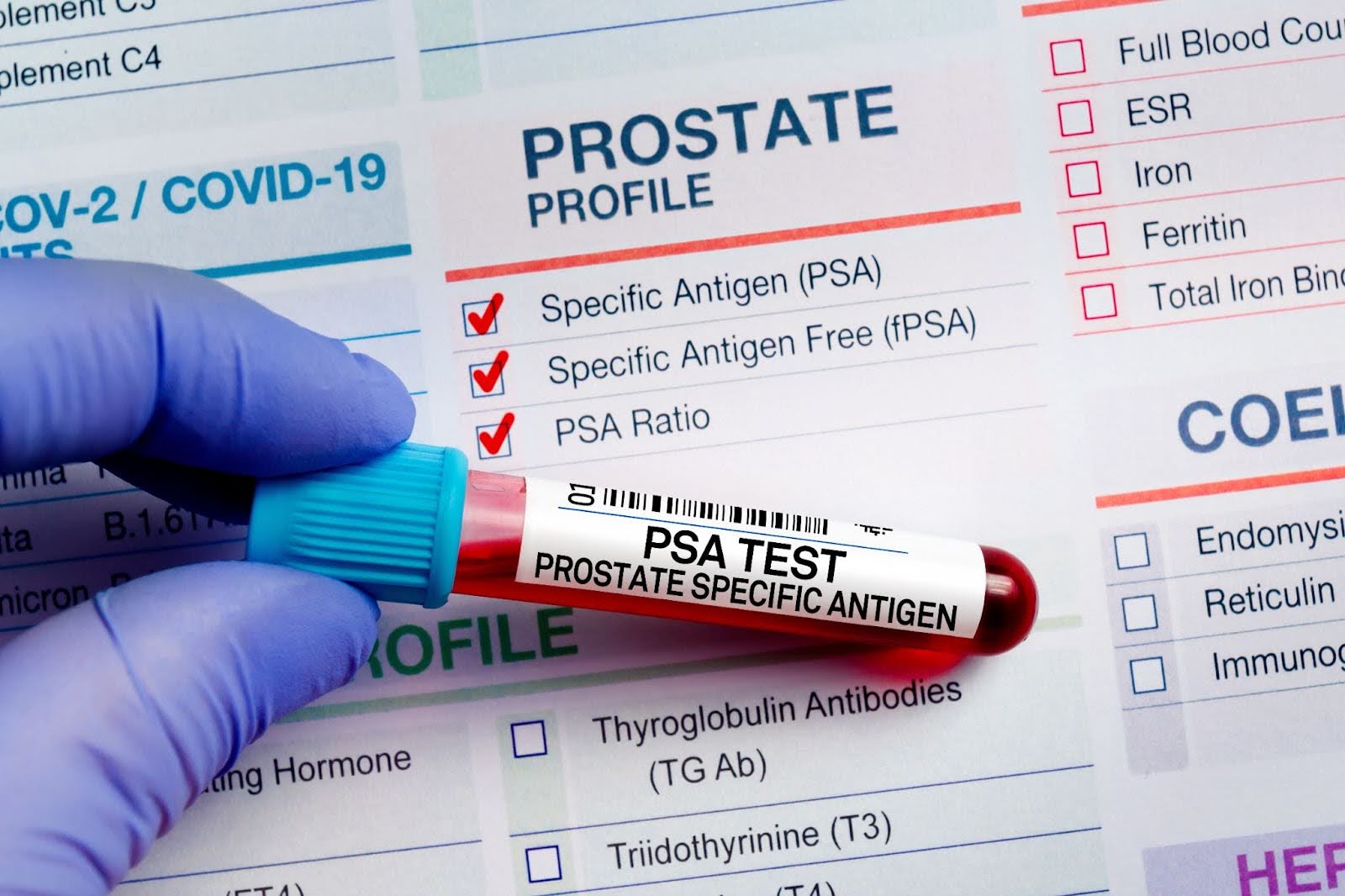 PSA Level Vial